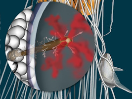 jelly stinging cell